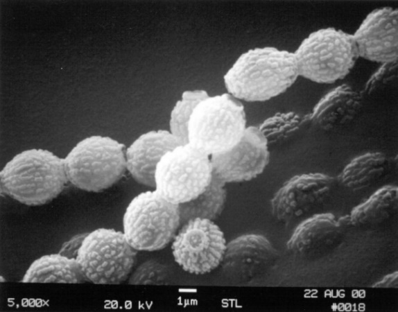 C:\Users\Owner\Desktop\Air v surface sampling\Aspergillus spore chain SEM 5k jpg .jpg