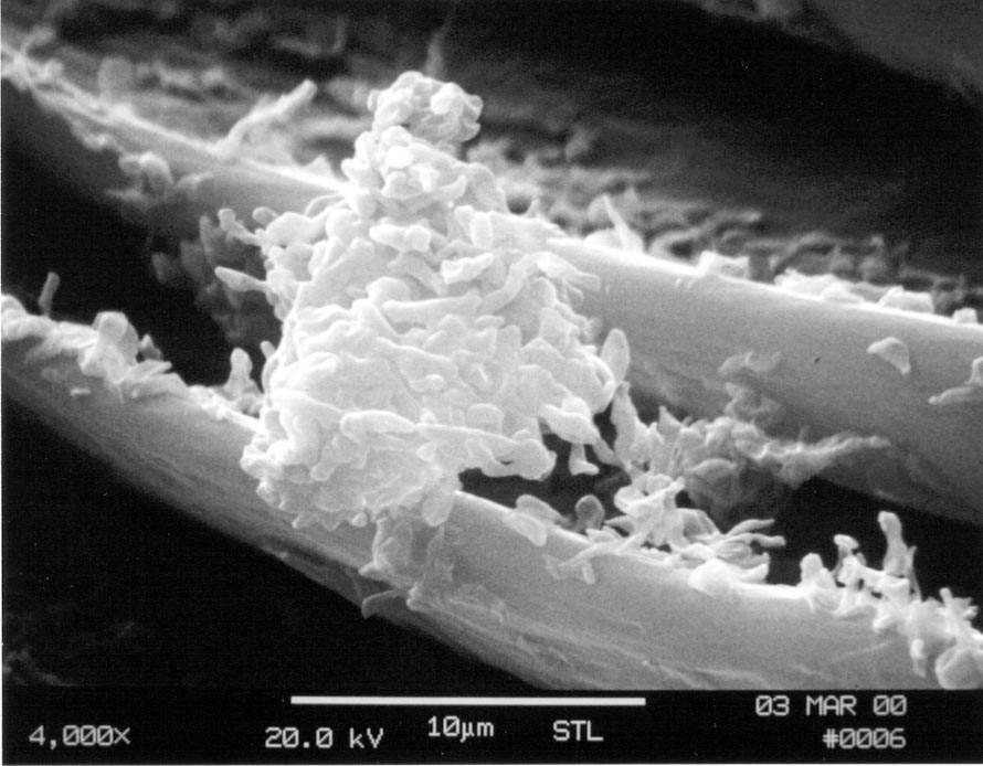 C:\Users\Owner\Desktop\Air v surface sampling\respirable bird bloom particles on a cockatiel's wing 4000x SEM.JPG