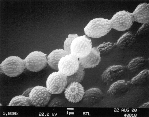 E:\Documents\SEM 061209\Aspergillus spore chain SEM 5k jpg .jpg